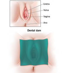 Láminas/barreras  para sexo oral anal o vaginal de fresa